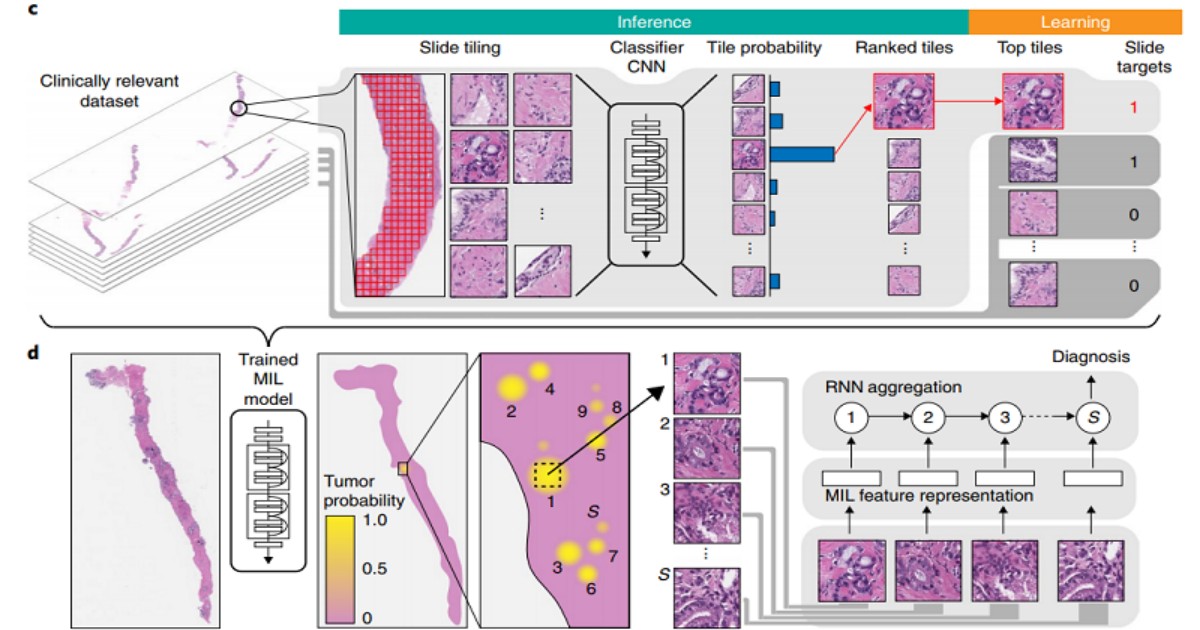 《Nature》首個臨床級病理AI問世 4萬張切片辨識準確率達98%